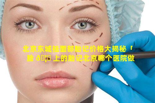 北京东城祛面部胎记价格大揭秘「脸 🦁 上的胎记北京哪个医院做的好」